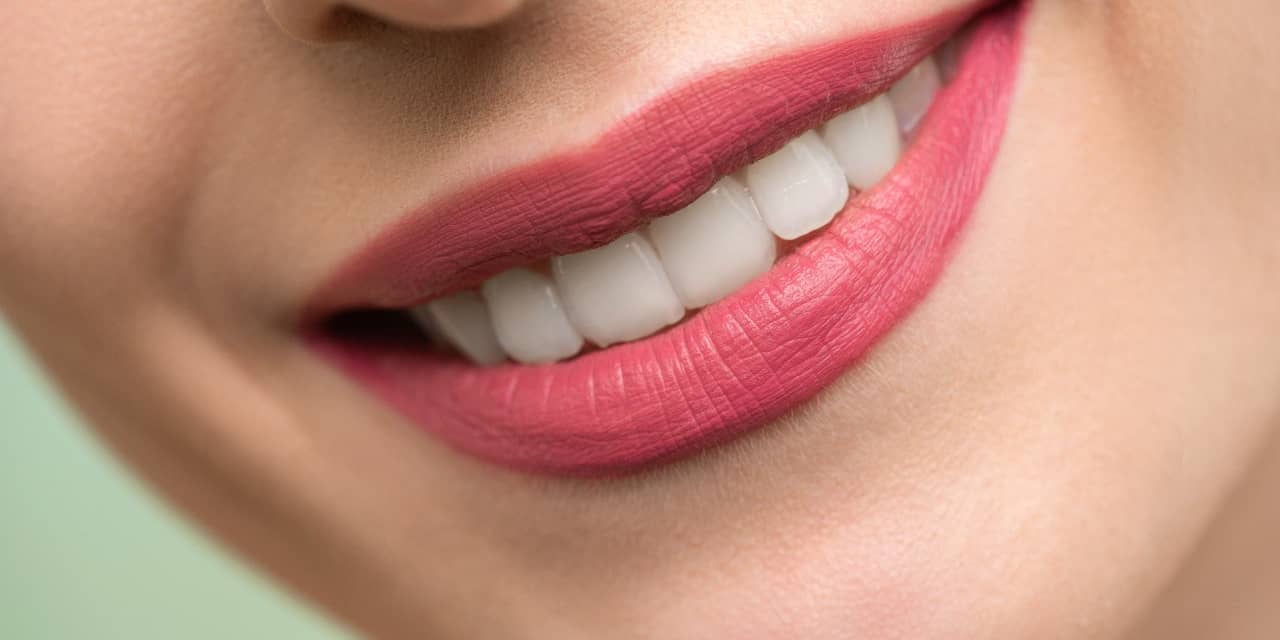 How often should you get your teeth whitened?